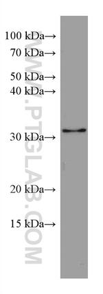 GEMIN8 Antibody in Western Blot (WB)