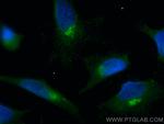 TMED10 Antibody in Immunocytochemistry (ICC/IF)