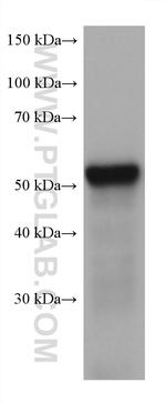 LPCAT3 Antibody in Western Blot (WB)