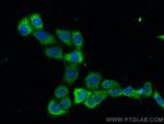 ADC Antibody in Immunocytochemistry (ICC/IF)