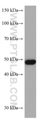 ADC Antibody in Western Blot (WB)