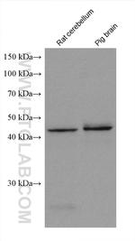 ADC Antibody in Western Blot (WB)