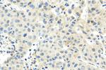 CDK7 Antibody in Immunohistochemistry (Paraffin) (IHC (P))