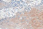 GARS Antibody in Immunohistochemistry (Paraffin) (IHC (P))