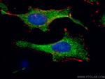 KBTBD2 Antibody in Immunocytochemistry (ICC/IF)