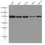 KBTBD2 Antibody in Western Blot (WB)