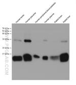 HBB Antibody in Western Blot (WB)