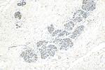 CIB1 Antibody in Immunohistochemistry (Paraffin) (IHC (P))