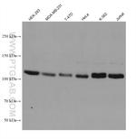 ROR2 Antibody in Western Blot (WB)