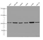 AlaRS Antibody in Western Blot (WB)