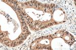 PSMA1 Antibody in Immunohistochemistry (Paraffin) (IHC (P))