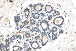 DDX3 Antibody in Immunohistochemistry (Paraffin) (IHC (P))