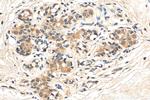 DDX3 Antibody in Immunohistochemistry (Paraffin) (IHC (P))