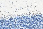 ROBO1 Antibody in Immunohistochemistry (Paraffin) (IHC (P))