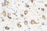 ROBO1 Antibody in Immunohistochemistry (Paraffin) (IHC (P))