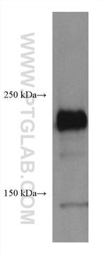 ROBO1 Antibody in Western Blot (WB)