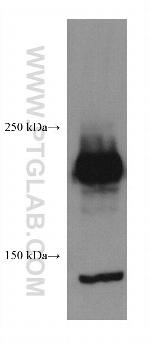 ROBO1 Antibody in Western Blot (WB)