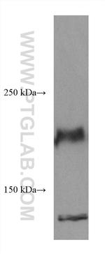 ROBO1 Antibody in Western Blot (WB)