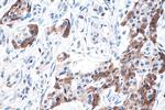 DLK1 Antibody in Immunohistochemistry (Paraffin) (IHC (P))