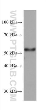 DLK1 Antibody in Western Blot (WB)