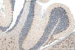 FARSB Antibody in Immunohistochemistry (Paraffin) (IHC (P))