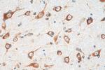 FARSB Antibody in Immunohistochemistry (Paraffin) (IHC (P))