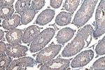 SLC36A3 Antibody in Immunohistochemistry (Paraffin) (IHC (P))