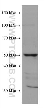 SLC36A3 Antibody in Western Blot (WB)
