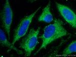 SCAMP3 Antibody in Immunocytochemistry (ICC/IF)