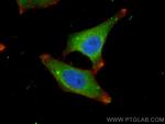 CARS Antibody in Immunocytochemistry (ICC/IF)