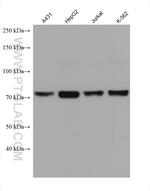 CARS Antibody in Western Blot (WB)