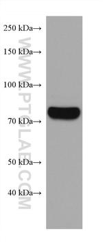 CARS Antibody in Western Blot (WB)