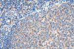 ValRS Antibody in Immunohistochemistry (Paraffin) (IHC (P))