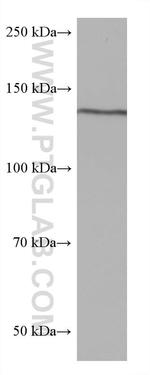 ValRS Antibody in Western Blot (WB)