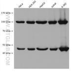 GART Antibody in Western Blot (WB)