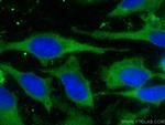 LARS Antibody in Immunocytochemistry (ICC/IF)