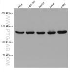 LARS Antibody in Western Blot (WB)