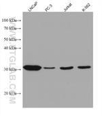 NAT1 Antibody in Western Blot (WB)