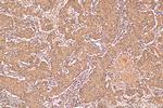 PARG Antibody in Immunohistochemistry (Paraffin) (IHC (P))