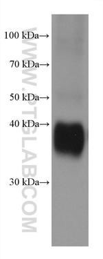 SERPINB9 Antibody in Western Blot (WB)