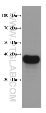 SERPINB9 Antibody in Western Blot (WB)