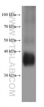 SERPINB9 Antibody in Western Blot (WB)