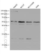 CLN3 Antibody in Western Blot (WB)