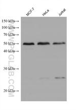 CLN3 Antibody in Western Blot (WB)