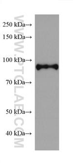 SATB2 Antibody in Western Blot (WB)