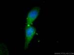 PSMB5 Antibody in Immunocytochemistry (ICC/IF)