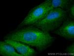 ABCE1 Antibody in Immunocytochemistry (ICC/IF)