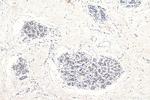 ABCE1 Antibody in Immunohistochemistry (Paraffin) (IHC (P))