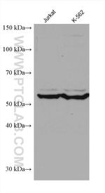 CCT6B Antibody in Western Blot (WB)