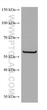 CCT6B Antibody in Western Blot (WB)